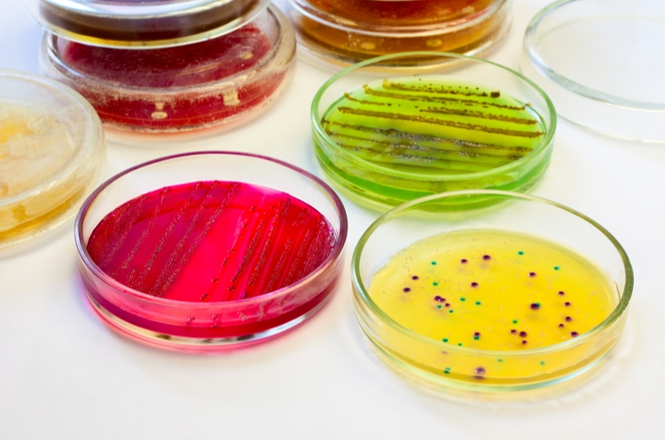 bacterial culture